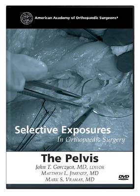 selectiveexposuresinorthopaedicsurgerythepelvis